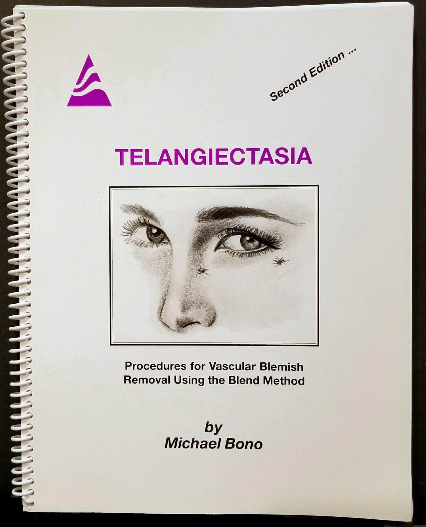 Telangiectasia - 2nd Edition by Michael Bono, is a comprehensive guide exploring the causes, treatments, and management of telangiectasia.